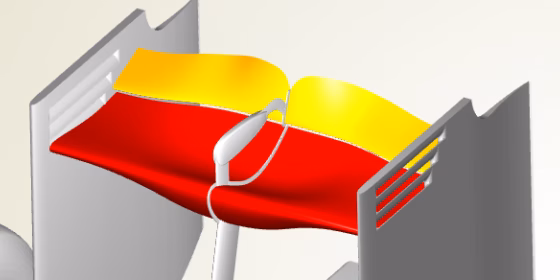parametricrearwing
