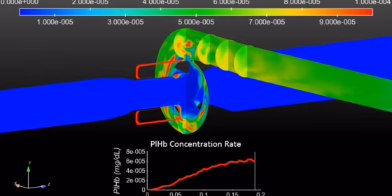 Ventricular-Assist-Device-Flow